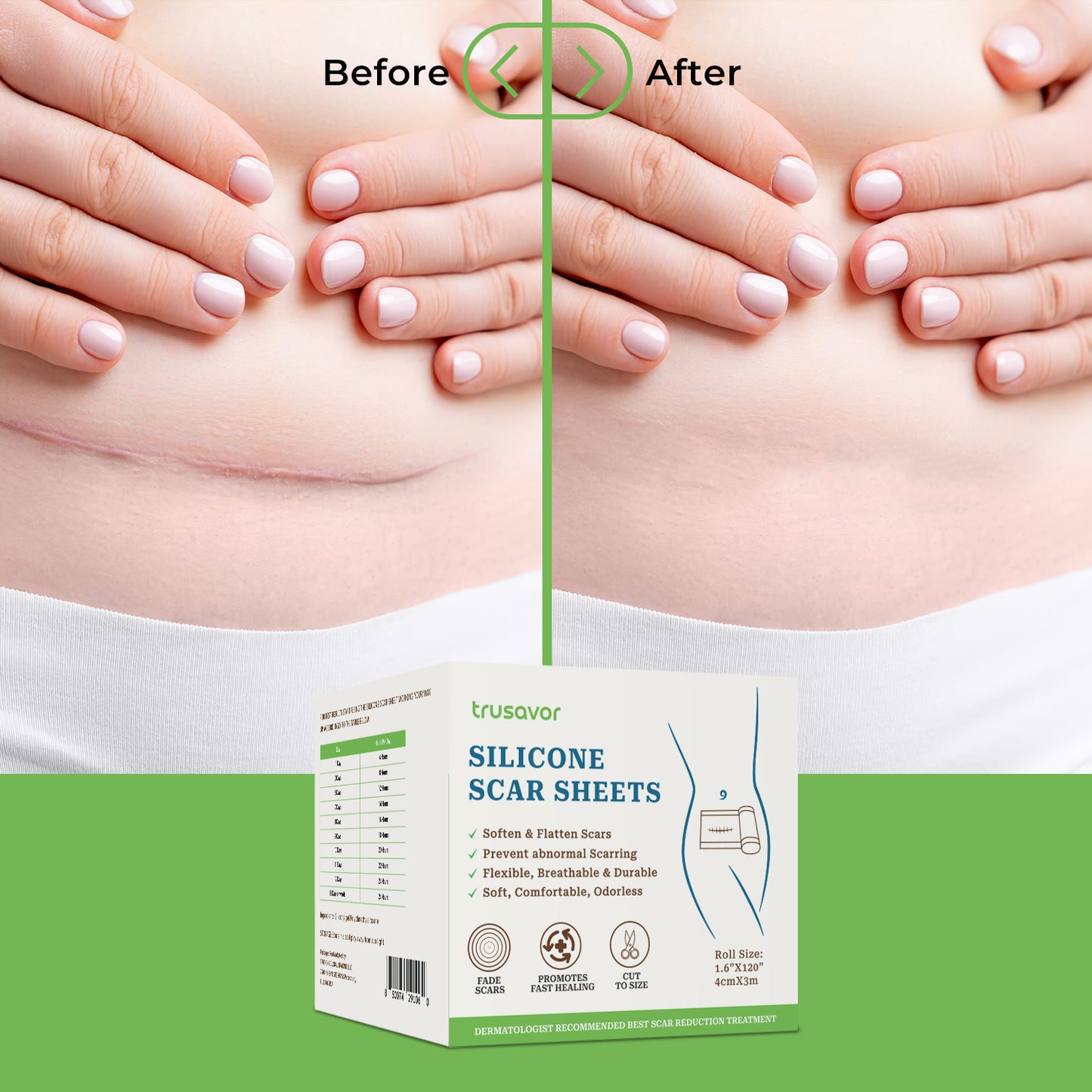 Trusavor Silicone Scar Sheets – Reusable, Breathable & Pain-Relieving Tape for Scar Treatment