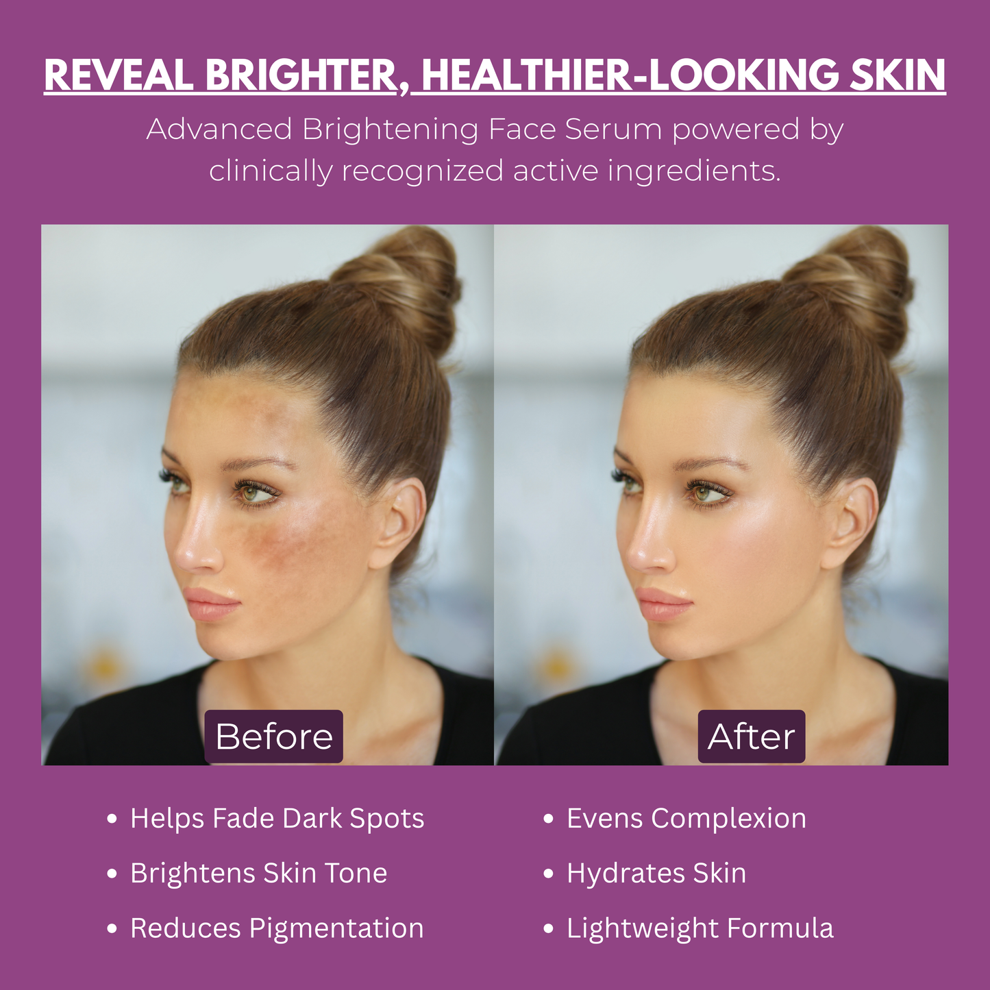 Trusavor Brightening Face Serum | Kojic Acid, Glutathione, Alpha Arbutin & Vitamin C | Hyaluronic Acid & Squalane | Fades Dark Spots & Hyperpigmentation | Lightweight | For Women & Men | 30 ml