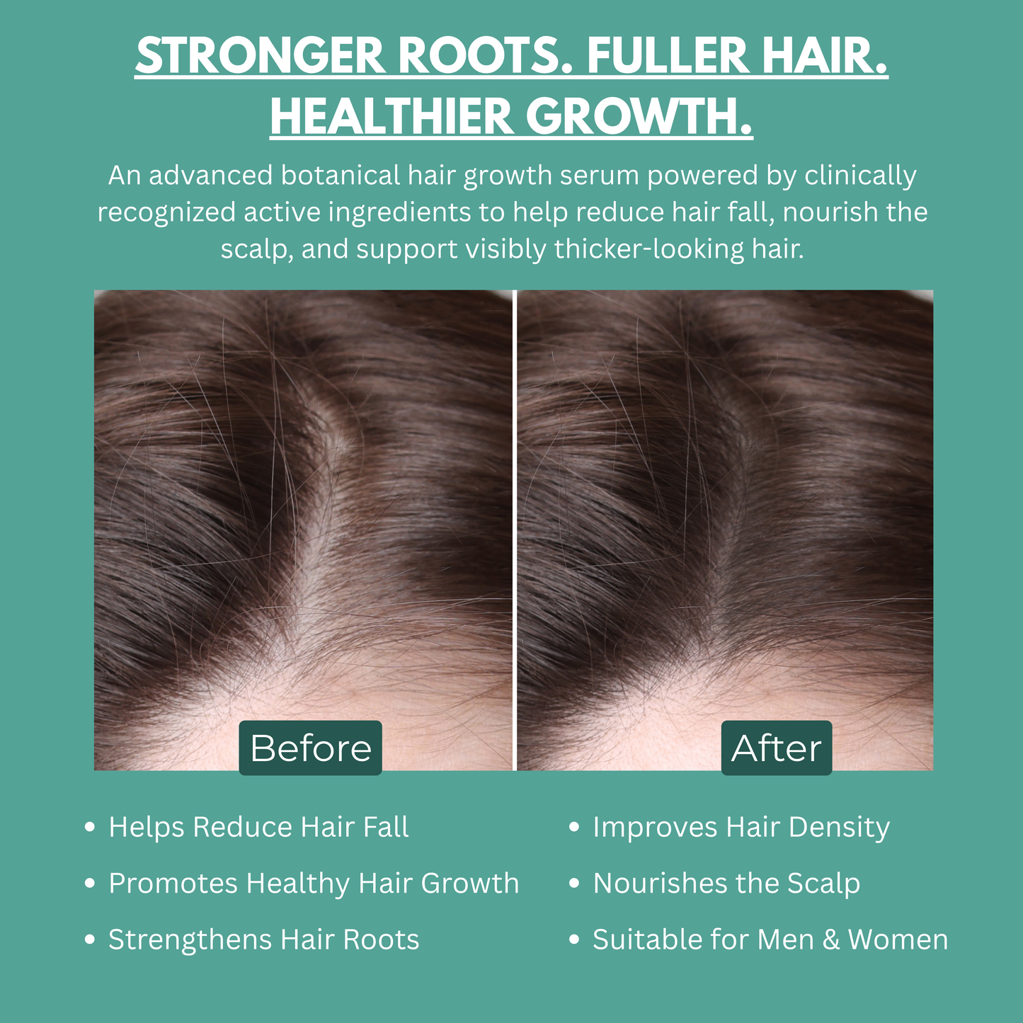 Trusavor Botanical Hair Growth Serum 30 ml | 4% Anagain, 3% Redensyl, 2% Baicapil, 2% Saw Palmetto & Biotin | Thicker & Stronger Hair | Prevents Hair Fall & Stimulates Follicles | For All Hair Types